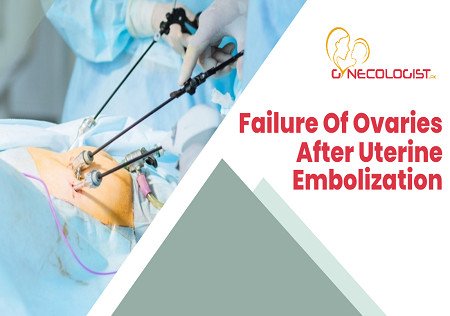 Failure Of Ovaries After Uterine Embolization